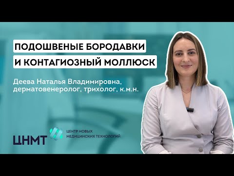 Видео: Подошвенные бородавки (шипицы) и моллюск: профилактика и лечение