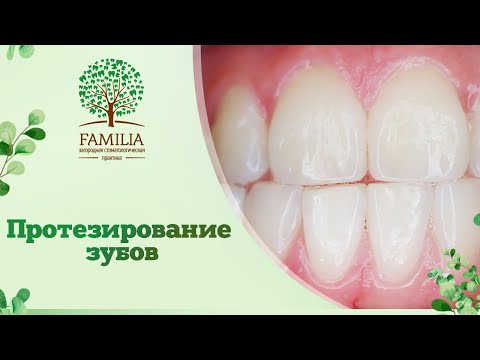 Видео: 🦷 Протезирование зубов