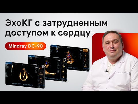 Видео: Эхокардиография с затрудненным доступом к сердцу на Mindray DC-90