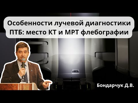 Видео: Доклад "Особенности лучевой диагностики ПТБ: место КТ и МРТ флебографии" (17.06.2023)