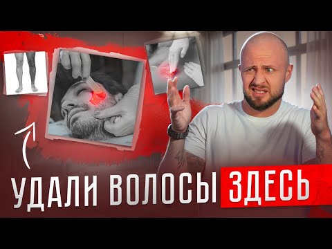 Видео: ПОЛНЫЙ гайд по УДАЛЕНИЮ ВОЛОС для НАСТОЯЩЕГО мужчины. Чем удалять волосы?