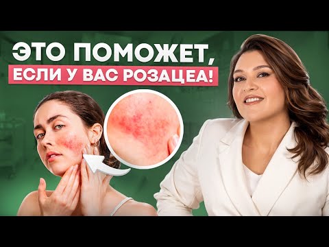 Видео: Что делать, если у вас РОЗАЦЕА? Лучшие средства и процедуры для улучшения кожи в этом видео!