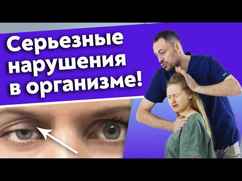 Видео: Птоз века / Как решить проблему нависающего века?