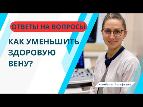 Видео: КАК УМЕНЬШИТЬ ВЕНУ?