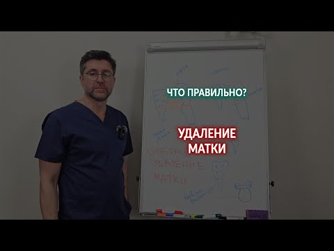 Видео: Удаление матки при опущении. Да или Нет?