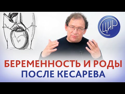 Видео: Беременность и роды после кесарева сечения. На что обратить внимание. Рассказывает Гузов И.И.