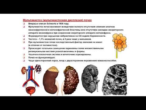 Видео: УЗИ. Доктор Иогансен. Выпуск 88. Неопухолевые очаговые изменения почек. Часть 2.