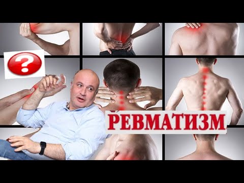 Видео: РЕВМАТИЗМ. Острая ревматическая лихорадка. Во всём виновато горло?