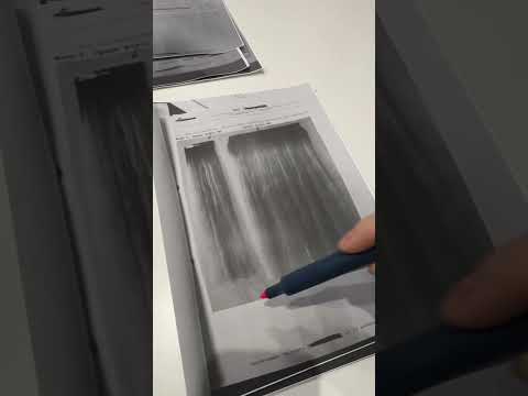 Видео: Судебный эксперт по волосам, наращиванию волос.