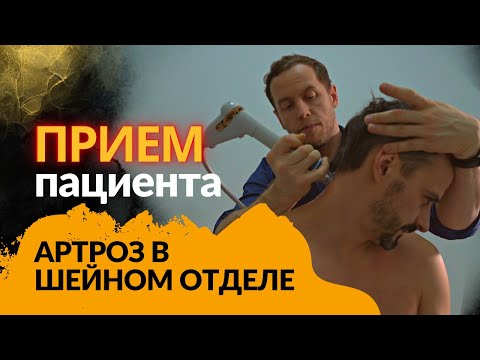 Видео: Артроз в шее | Как лечить? | Правка АТЛАНТА не помогла