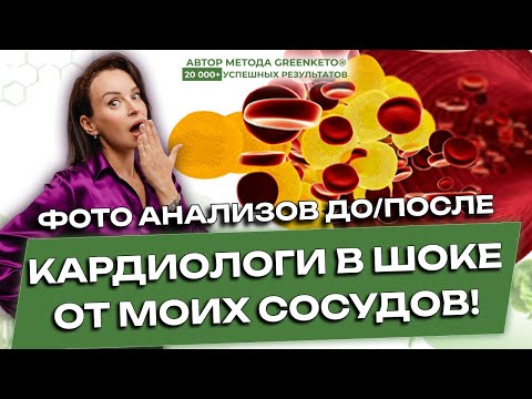 Видео: Холестерин и кето: правда о жирах и сердце [мои анализы спустя 8 лет]