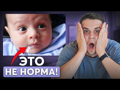 Видео: Когда младенцу нужна СКОРАЯ ПОМОЩЬ? Самые ОПАСНЫЕ состояния новорожденного!