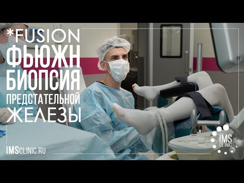 Видео: Фьюжн (fusion) биопсия простаты
