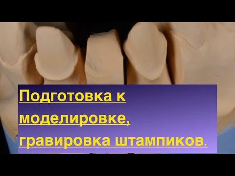 Видео: Подготавливаем модель и штампики к восковой моделировке каркаса  Гравировка зубов