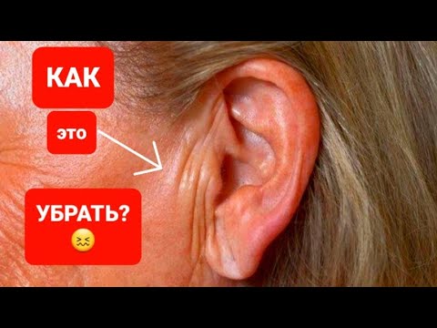 Видео: КАК УБРАТЬ морщины возле уха