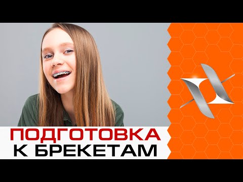 Видео: 5 ВЕЩЕЙ, которые НУЖНО СДЕЛАТЬ ДО БРЕКЕТОВ. Подготовка к ортодонтическому лечению.