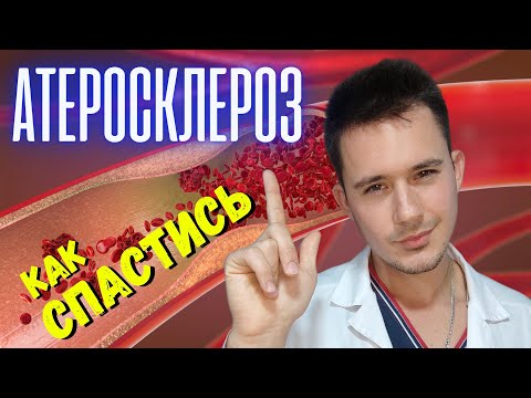 Видео: Лечение атеросклероза! Чего боятся бляшки в сосудах?