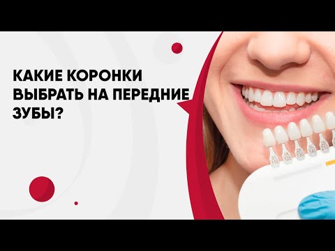 Видео: Какие коронки выбрать на передние зубы