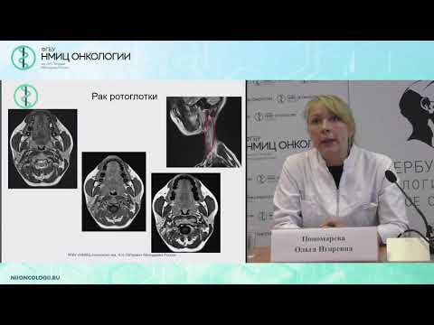 Видео: Диагностическая ценности МРТ исследования при метастатическом поражении лимфатических узлов