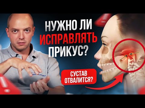 Видео: Неправильный прикус. Зачем его исправлять и кому это нужно?