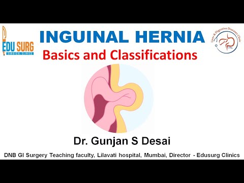 Видео: 5 типов паховых грыж, о которых вам нужно знать l Грыжа, о которой легко узнать