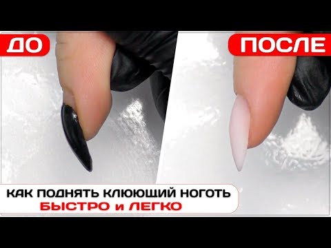 Видео: Как поднять клюющий ноготь быстро  ✅ПОЛИГЕЛЕМ наращивание миндаль ✅Наращивание ногтей акригель