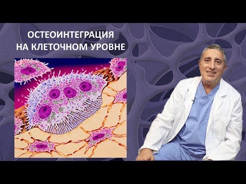 Видео: Остеоинтеграция. Приживление кости к титановому имплантату
