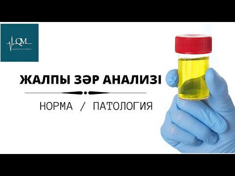 Видео: Жалпы зәр анализі | Норма | Патология