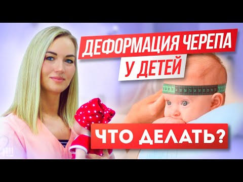 Видео: Деформация черепа у ДЕТЕЙ. Можно ли ИСПРАВИТЬ?
