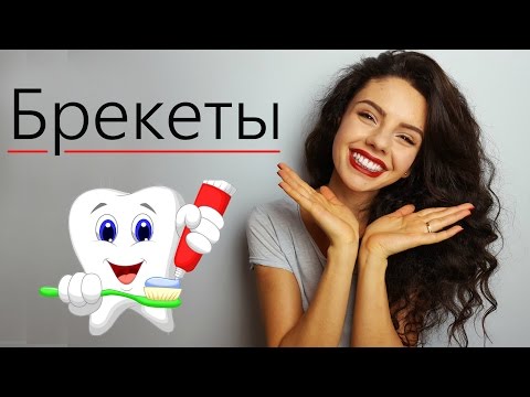 Видео: Брекеты ДО и ПОСЛЕ | Мой уход за зубами