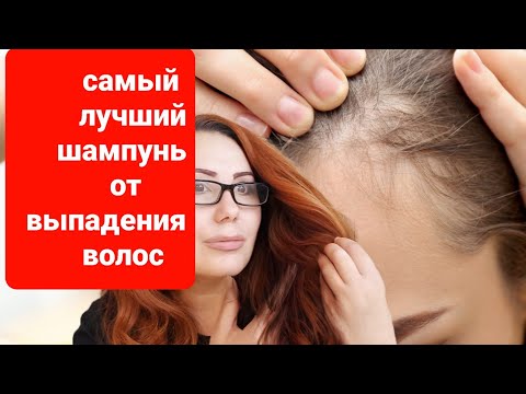 Видео: Самый сильный шампунь от выпадения волос! У меня волосы больше не выпадают!           С Лёгкой руки.