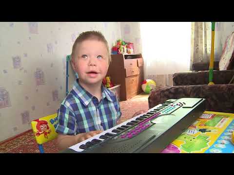 Видео: Синдром Вильямса