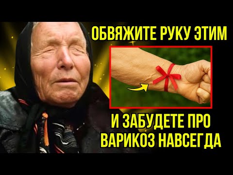 Видео: Наклейте эту ленту на руку и попрощайтесь с варикозным расширением вен без лекарств | Баба Ванга