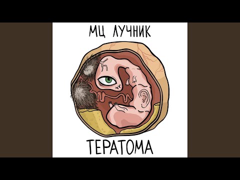 Видео: Тератома