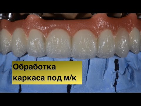 Видео: Обработка каркаса после литья. Каркас под металлокерамику. Делаем зубы. Каркас под м\к.