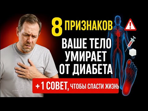 Видео: 8 ПРИЗНАКОВ – Ваше ТЕЛО УМИРАЕТ от ДИАБЕТА + 1 СОВЕТ, чтобы СПАСТИ ЖИЗНЬ