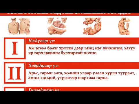 Видео: "Тэмбүүг утсгая"