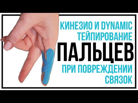 Видео: Кинезио и динамик тейпирование пальца при повреждении капсульно-связочного аппарата.