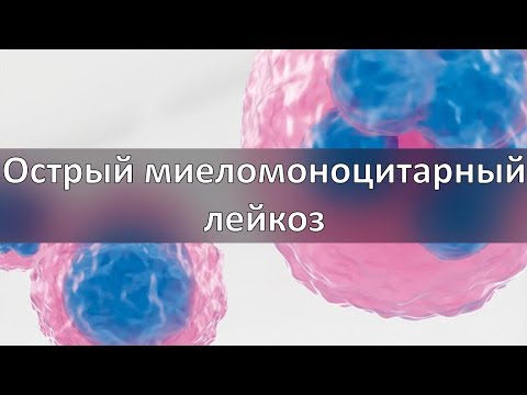 Видео: Острый миеломоноцитарный лейкоз