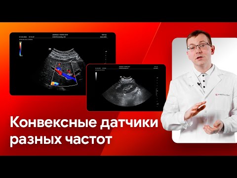 Видео: Сравнение конвексных датчиков УЗИ - Mindray SC6-1s / SC8-2s / C11-3s