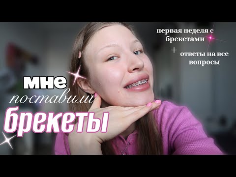Видео: МНЕ ПОСТАВИЛИ БРЕКЕТЫ/ первые ощущения, ответы на вопросы ВЛОГ