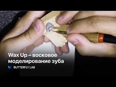Видео: Wax Up Live. Восковое моделирование зуба. Зубной техник