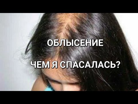 Видео: ВЫПАДЕНИЕ ВОЛОС у женщин