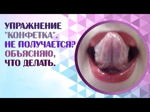 Видео: Артикуляционная гимнастика.  Упражнение "Конфетка".  Exercise Candy