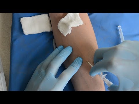 Видео: Катетеризация периферической вены / peripheral venous cannulation