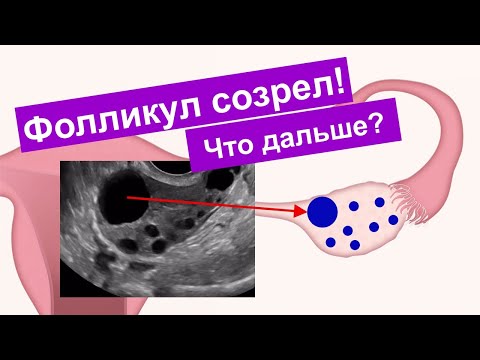 Видео: Овуляция и жёлтое тело в яичнике