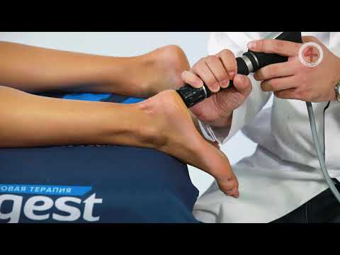 Видео: Плантарный Фасцит от доктора Евстаева