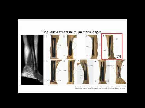 Видео: Менькова И.С. "МРТ диагностика нейропатий конечностей"