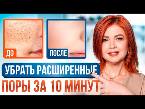 Видео: Сузить поры ЛЕГКО! / Как ДОБИТЬСЯ идеальной кожи в домашних условиях?