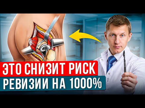 Видео: Не прижился протез тазобедренного сустава. Ревизионное эндопротезирование тазобедренного сустава.